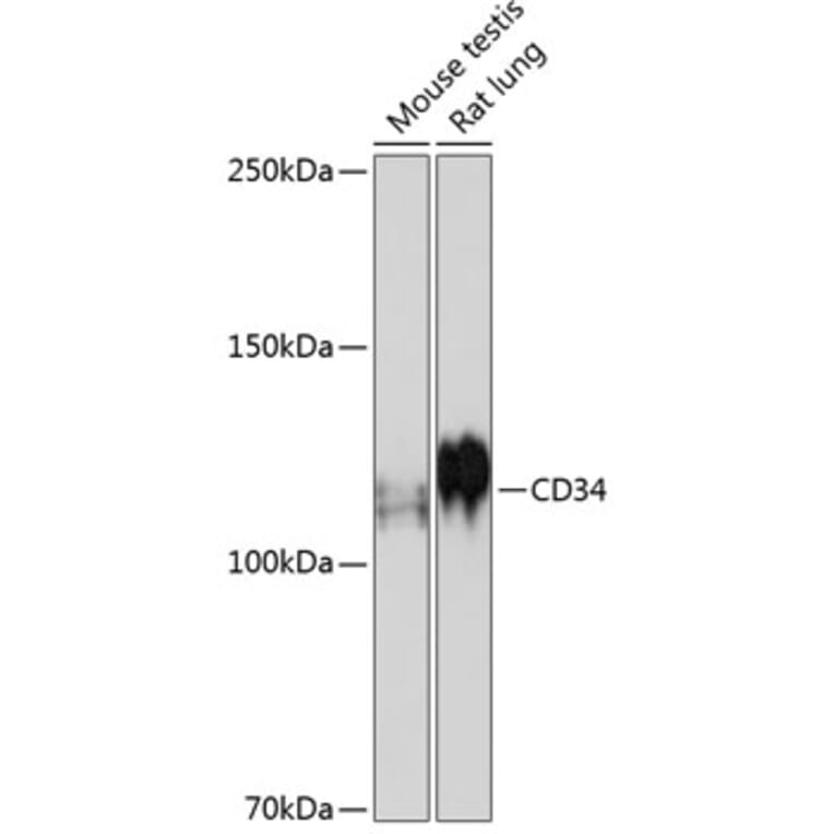Western Blot - Anti-CD34 Antibody [ARC0219] (A309259) - Antibodies.com