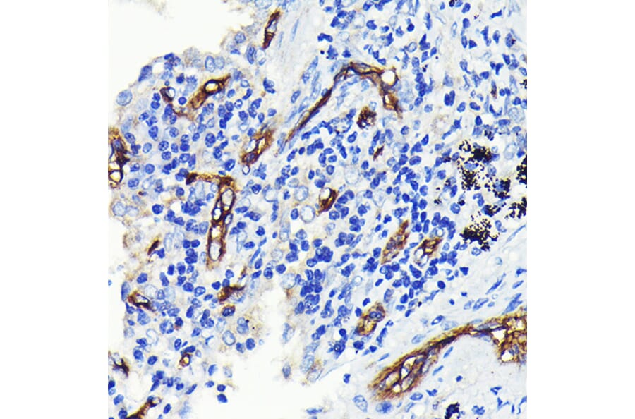Immunohistochemistry - Anti-CD34 Antibody [ARC0219] (A309259) - Antibodies.com