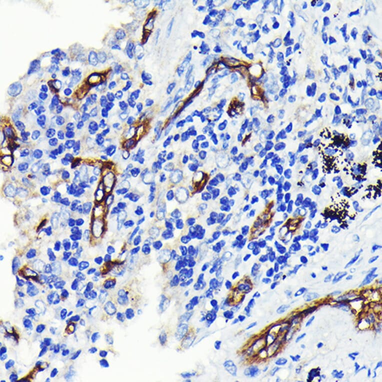 Immunohistochemistry - Anti-CD34 Antibody [ARC0219] (A309259) - Antibodies.com