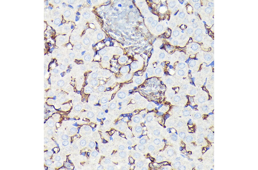 Immunohistochemistry - Anti-CD34 Antibody [ARC0219] (A309259) - Antibodies.com