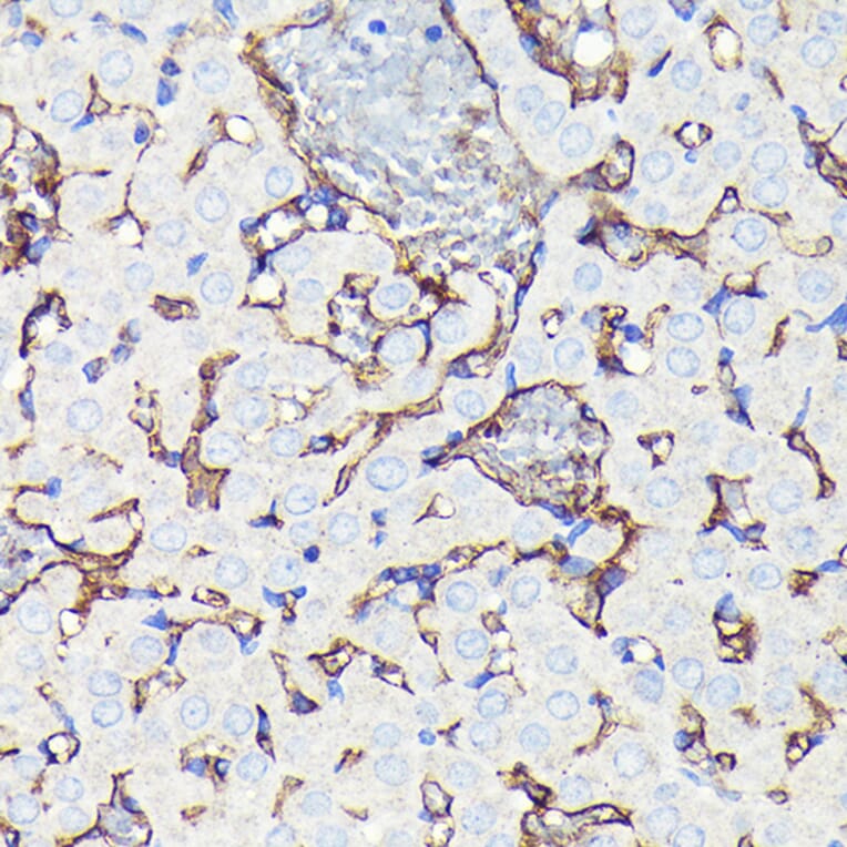 Immunohistochemistry - Anti-CD34 Antibody [ARC0219] (A309259) - Antibodies.com
