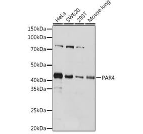 Western Blot - Anti-PAR4 Antibody [ARC1980] (A309260) - Antibodies.com