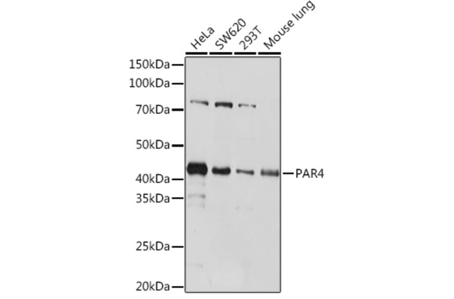 Western Blot - Anti-PAR4 Antibody [ARC1980] (A309260) - Antibodies.com