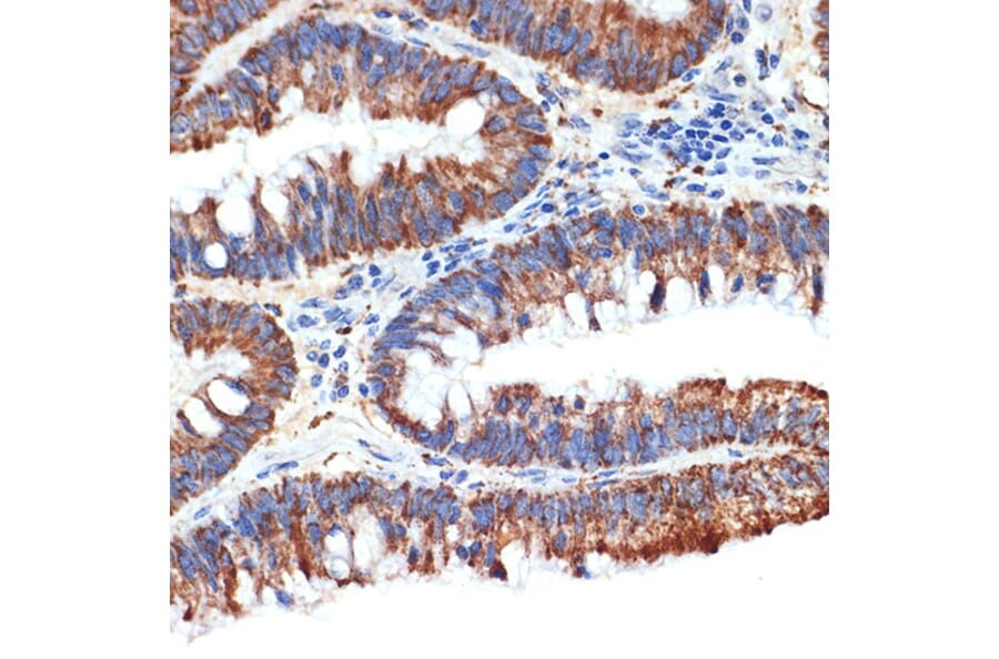 Immunohistochemistry - Anti-PAR4 Antibody [ARC1980] (A309260) - Antibodies.com