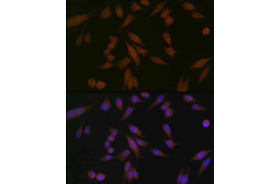 Immunofluorescence - Anti-PAR4 Antibody [ARC1980] (A309260) - Antibodies.com