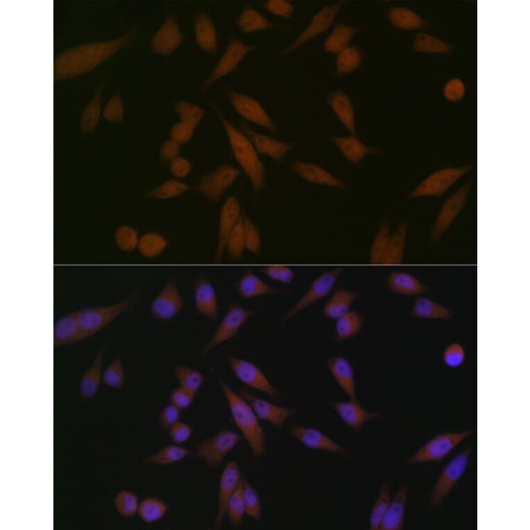 Immunofluorescence - Anti-PAR4 Antibody [ARC1980] (A309260) - Antibodies.com