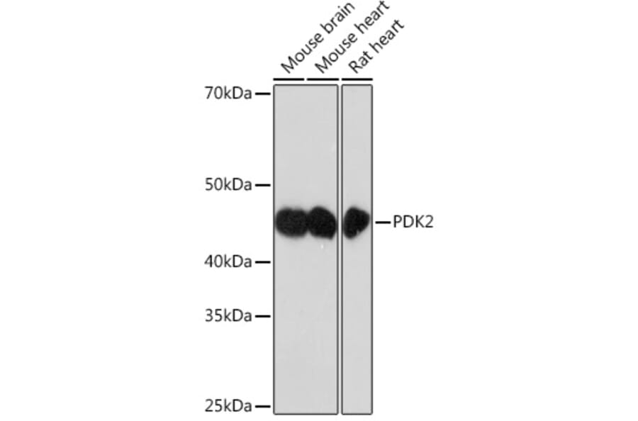 Western Blot - Anti-PDK2 Antibody [ARC1113] (A309261) - Antibodies.com