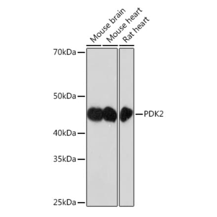 Western Blot - Anti-PDK2 Antibody [ARC1113] (A309261) - Antibodies.com