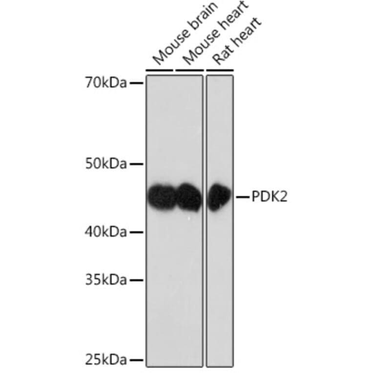 Western Blot - Anti-PDK2 Antibody [ARC1113] (A309261) - Antibodies.com