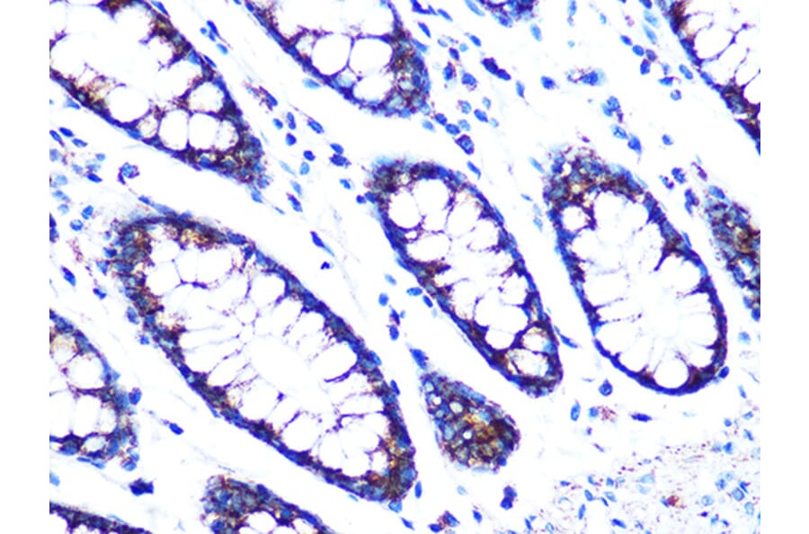 Immunohistochemistry - Anti-PDK2 Antibody [ARC1113] (A309261) - Antibodies.com