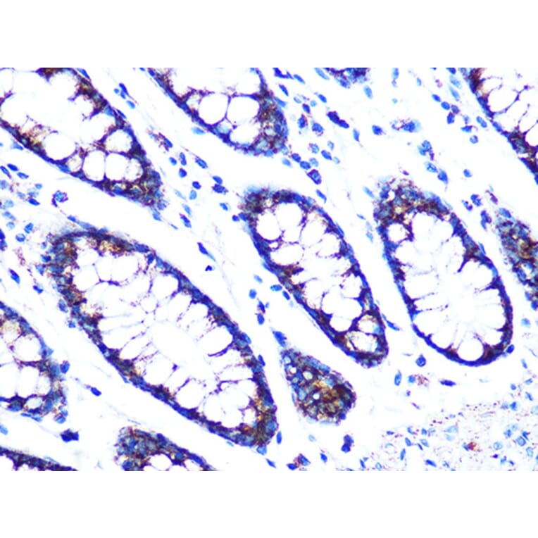 Immunohistochemistry - Anti-PDK2 Antibody [ARC1113] (A309261) - Antibodies.com