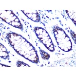 Immunohistochemistry - Anti-PDK2 Antibody [ARC1113] (A309261) - Antibodies.com