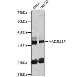 Western Blot - Anti-CMT2 Antibody [ARC2187] (A309262) - Antibodies.com