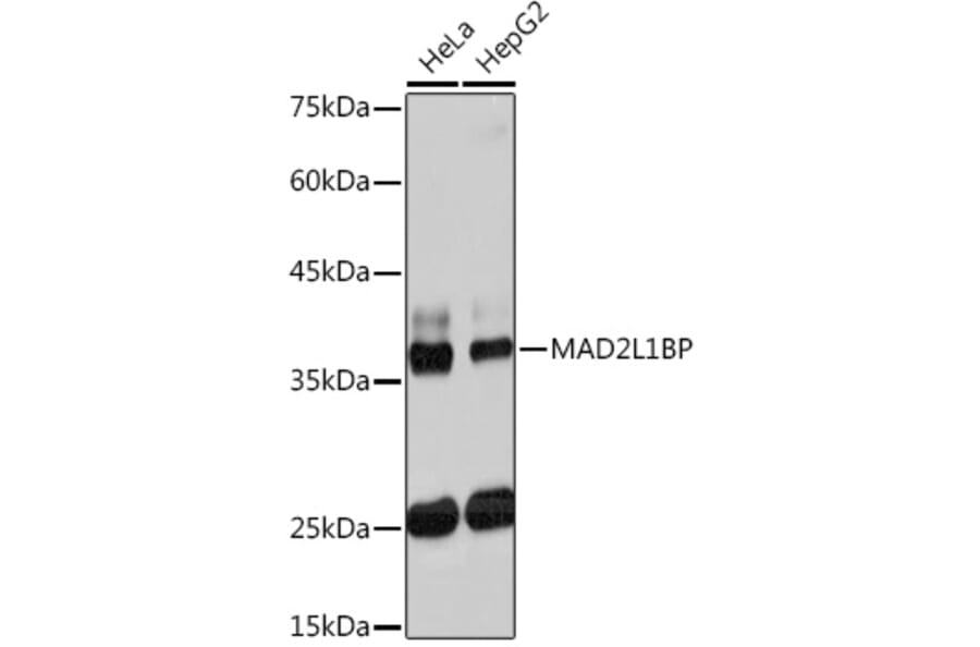 Western Blot - Anti-CMT2 Antibody [ARC2187] (A309262) - Antibodies.com