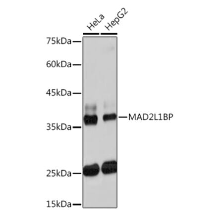 Western Blot - Anti-CMT2 Antibody [ARC2187] (A309262) - Antibodies.com