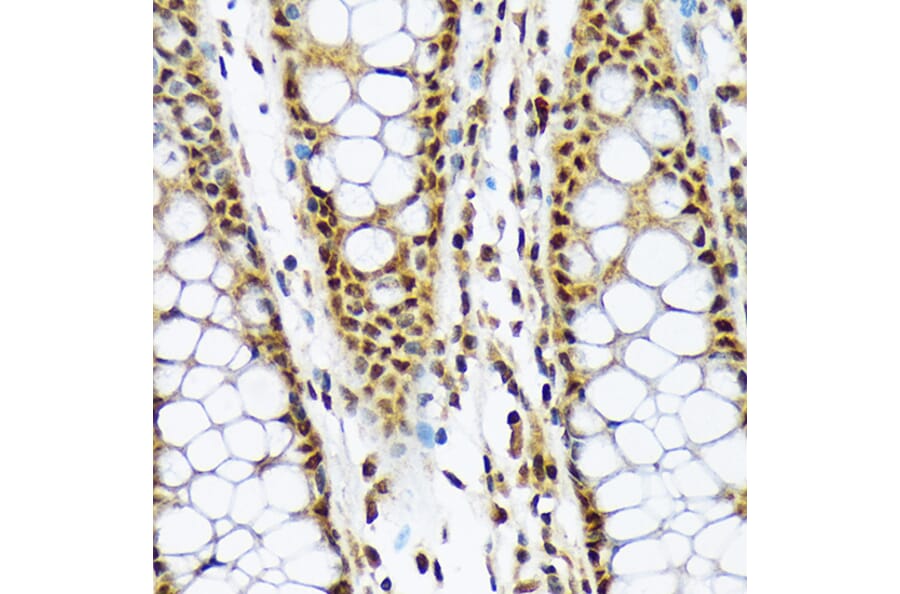 Immunohistochemistry - Anti-CMT2 Antibody [ARC2187] (A309262) - Antibodies.com