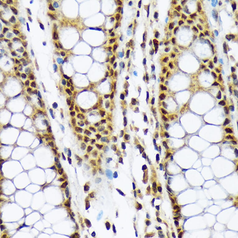 Immunohistochemistry - Anti-CMT2 Antibody [ARC2187] (A309262) - Antibodies.com