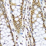 Immunohistochemistry - Anti-CMT2 Antibody [ARC2187] (A309262) - Antibodies.com