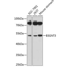Western Blot - Anti-B3GNT3 Antibody (A309266) - Antibodies.com