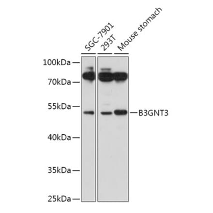 Western Blot - Anti-B3GNT3 Antibody (A309266) - Antibodies.com