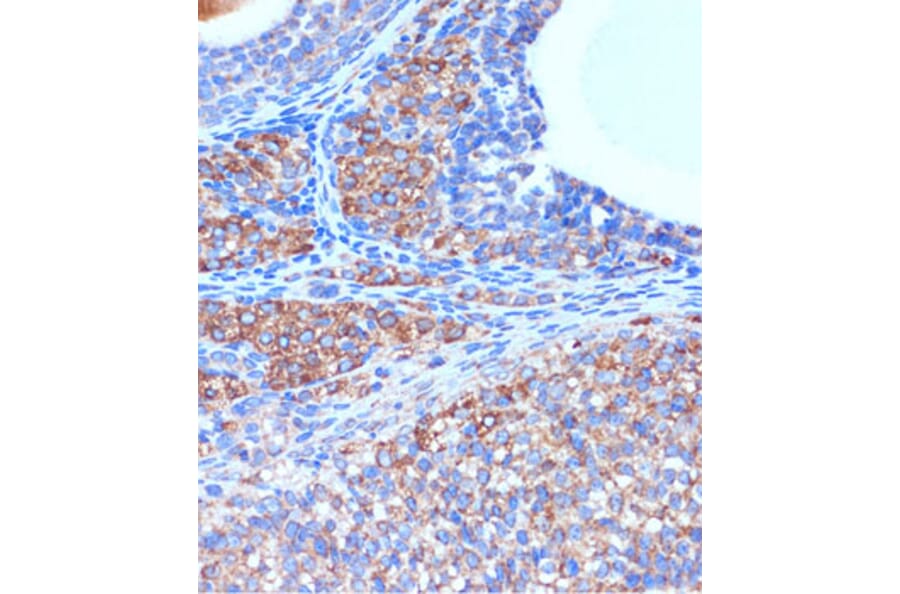 Immunohistochemistry - Anti-B3GNT3 Antibody (A309266) - Antibodies.com