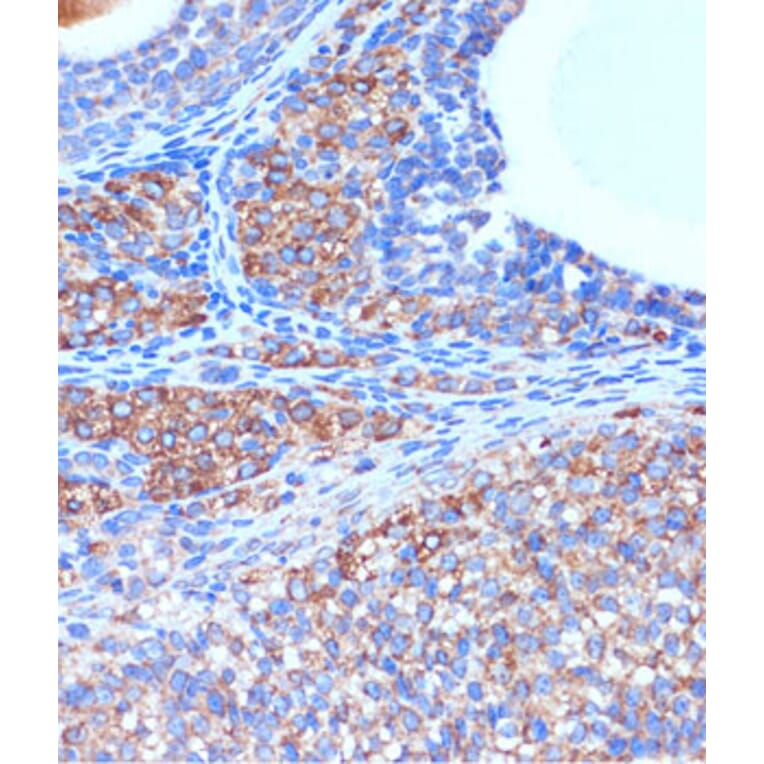 Immunohistochemistry - Anti-B3GNT3 Antibody (A309266) - Antibodies.com