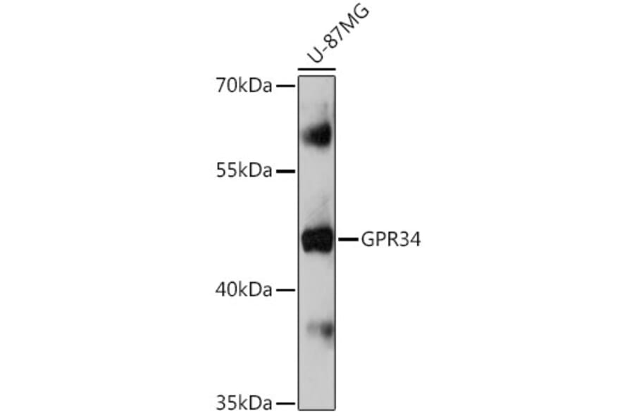 Western Blot - Anti-GPCR GPR34 Antibody (A309267) - Antibodies.com