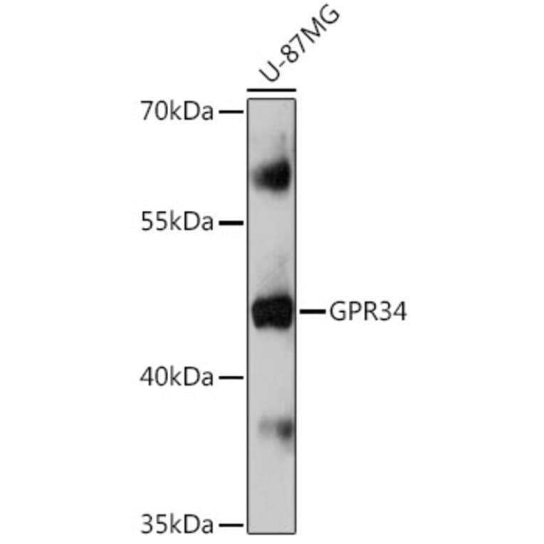 Western Blot - Anti-GPCR GPR34 Antibody (A309267) - Antibodies.com