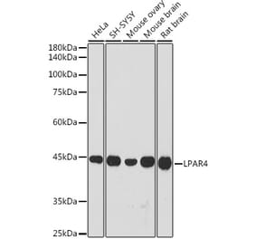 Western Blot - Anti-LPA-4 Antibody (A309269) - Antibodies.com