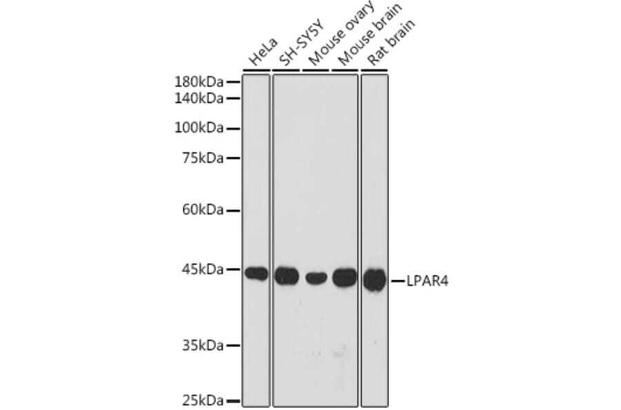 Western Blot - Anti-LPA-4 Antibody (A309269) - Antibodies.com