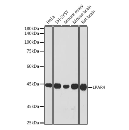Western Blot - Anti-LPA-4 Antibody (A309269) - Antibodies.com