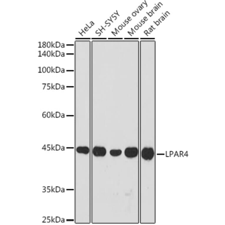 Western Blot - Anti-LPA-4 Antibody (A309269) - Antibodies.com