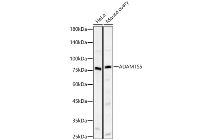 Western Blot - Anti-ADAMTS5 Antibody [ARC59326] (A309273) - Antibodies.com