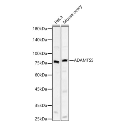 Western Blot - Anti-ADAMTS5 Antibody [ARC59326] (A309273) - Antibodies.com