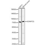 Western Blot - Anti-ADAMTS5 Antibody [ARC59326] (A309273) - Antibodies.com