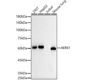 Western Blot - Anti-AER61 Antibody (A309276) - Antibodies.com