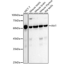 Western Blot - Anti-AKT1 Antibody [ARC51585] (A309277) - Antibodies.com
