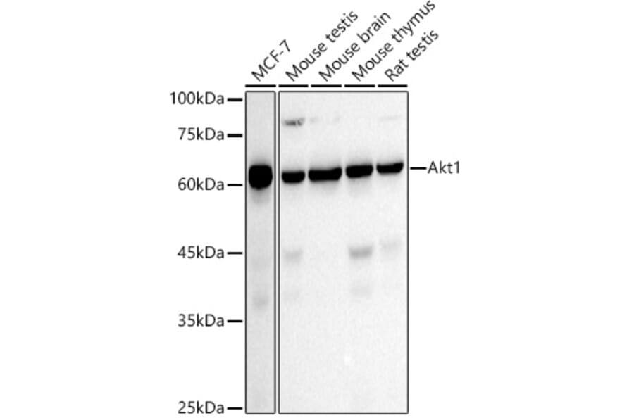 Western Blot - Anti-AKT1 Antibody [ARC51585] (A309277) - Antibodies.com