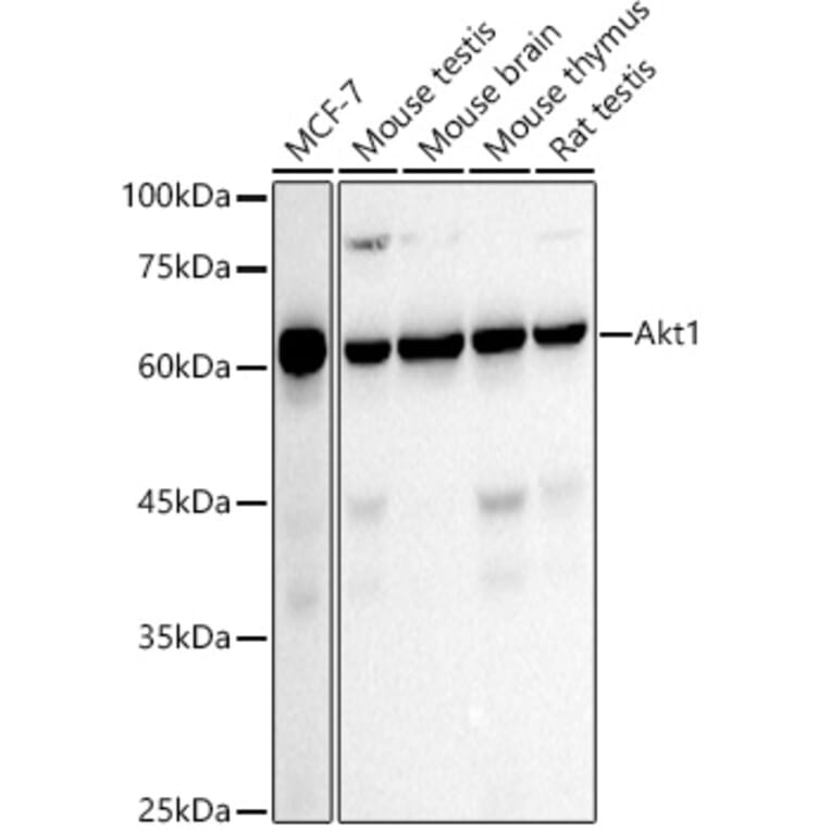 Western Blot - Anti-AKT1 Antibody [ARC51585] (A309277) - Antibodies.com