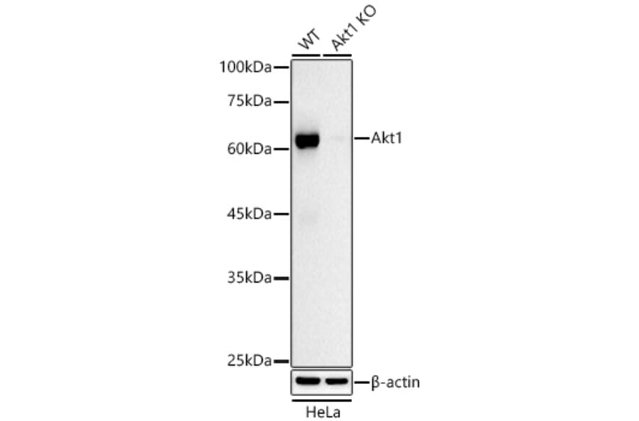 Western Blot - Anti-AKT1 Antibody [ARC51585] (A309277) - Antibodies.com