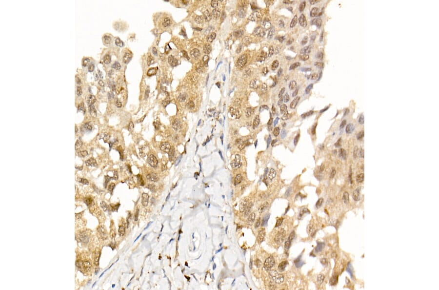Immunohistochemistry - Anti-AKT1 Antibody [ARC51585] (A309277) - Antibodies.com