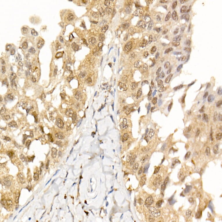 Immunohistochemistry - Anti-AKT1 Antibody [ARC51585] (A309277) - Antibodies.com