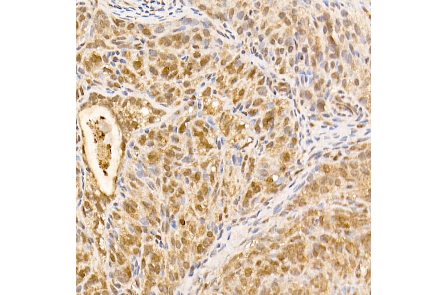 Immunohistochemistry - Anti-AKT1 Antibody [ARC51585] (A309277) - Antibodies.com