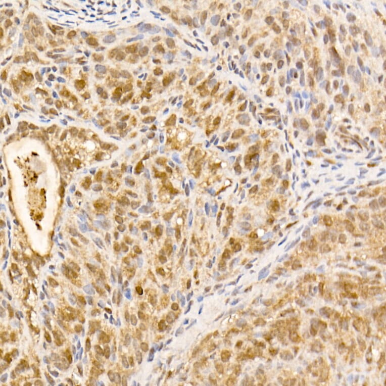 Immunohistochemistry - Anti-AKT1 Antibody [ARC51585] (A309277) - Antibodies.com