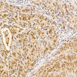 Immunohistochemistry - Anti-AKT1 Antibody [ARC51585] (A309277) - Antibodies.com