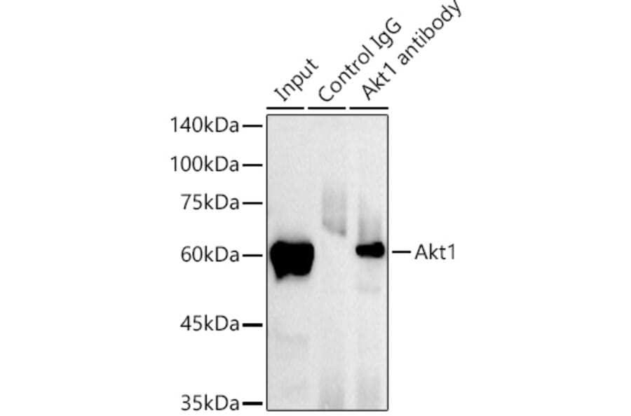 Western Blot - Anti-AKT1 Antibody [ARC51585] (A309277) - Antibodies.com