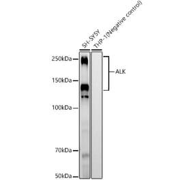 Western Blot - Anti-ALK Antibody [ARC58012] (A309279) - Antibodies.com