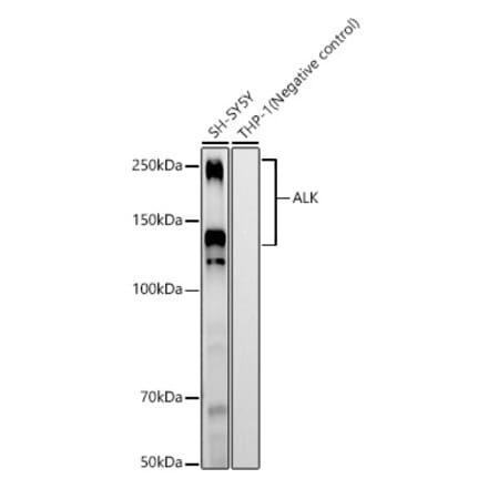 Western Blot - Anti-ALK Antibody [ARC58012] (A309279) - Antibodies.com