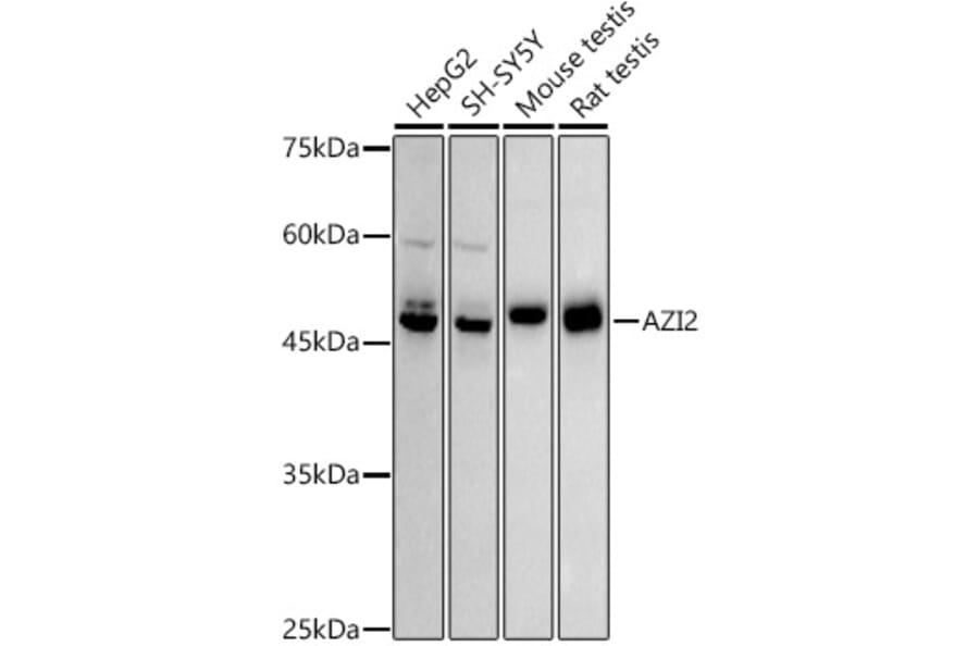 Western Blot - Anti-AZI2 Antibody [ARC2987] (A309286) - Antibodies.com