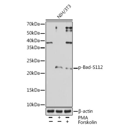 Western Blot - Anti-Bad (phospho Ser112) Antibody [ARC1555] (A309287) - Antibodies.com
